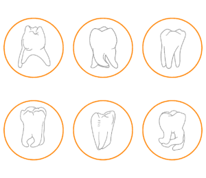 wisdom teeth shapes