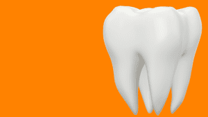 wisdom tooth cover