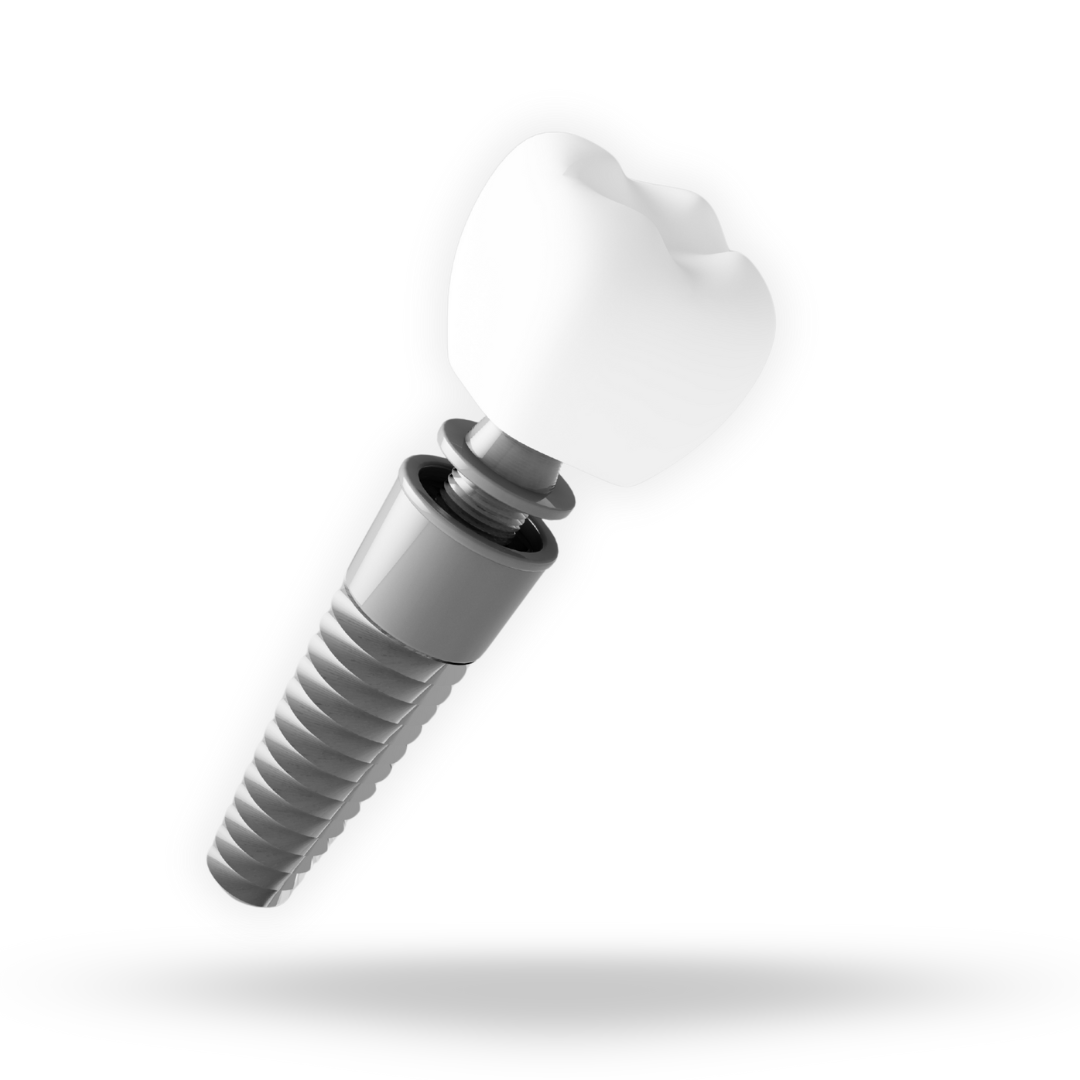 Dental Implant dental implant